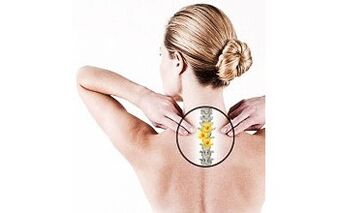 Moterų gimdos kaklelio osteochondrozė