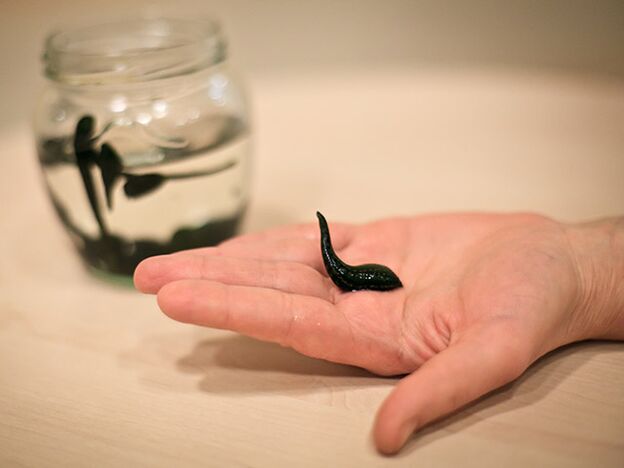 Taikymas kelio sąnario artrozei gydyti